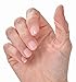 3-Point Products Oval-8 Finger Splint Combo Pack, Sizes 10, 11, 12, 13, 14