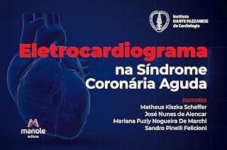 Eletrocardiograma na síndrome coronária aguda