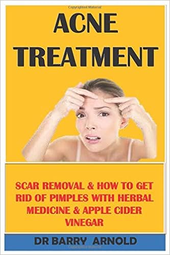 herbal acne treatment