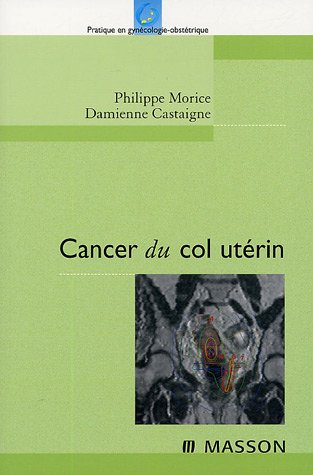 Cancer du col utérin