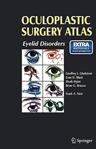 Atlas of Oculoplastic and Orbital Surgery: 9781841845869: Medicine