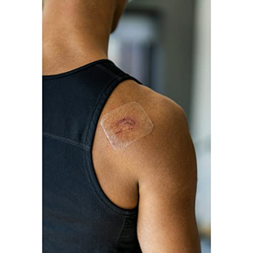 NEXCARE TEGADERM TRANSPARENT DRESSING, CLEAR FILM LETS YOU SEE WOUNDS HEAL, WATERPROOF DRESSING HOLDS FAST FOR 7 DAYS – 10 DRESSINGS