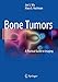 Bone Tumors: A Practical Guide to Imaging