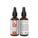 You're Beautiful International Organic 25% Vitamin C Anti-Aging Serum with Hyaluronic Acid for Face, 1 oz.