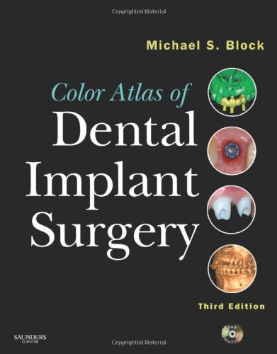 Color Atlas of Dental Implant Surgery, 3e, by Michael S. Block DMD Color Atlas of Dental Implant Surgery, 3e, by Michael S. Block DMD