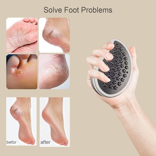 Professional Crystal Hair Remover - Nano Glass Epilator & Exfoliator 2-in-1 Glass Nano-Crystallization Hair Eraser (Prevents Razor Bumps) + Foot Exfoliator with Debris Cup, Reusable Unisex Gift