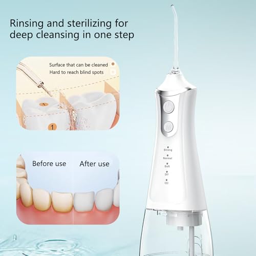Water Flossers for Teeth, Portable Dental Water Floss for Tooth Cleaning, Cordless Oral Irrigator with 5 Tips & Jet Storage Case, Rechargeable 300mL Flosser for Travel, IPX7 خيط مائي للأسنان