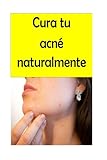 Image de Cura tu acné naturalmente (Spanish Edition)