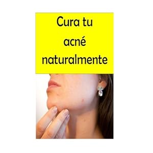 Cura tu acné naturalmente (Spanish Edition)