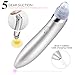 Pretid Blackhead Remover, USB Rechargeable Blackhead Comedo Vacuum Suction Acne Extractor, Skin Pore Cleanser Microdermabrasion Machine With 4 Replaceable Suction Heads (White)
