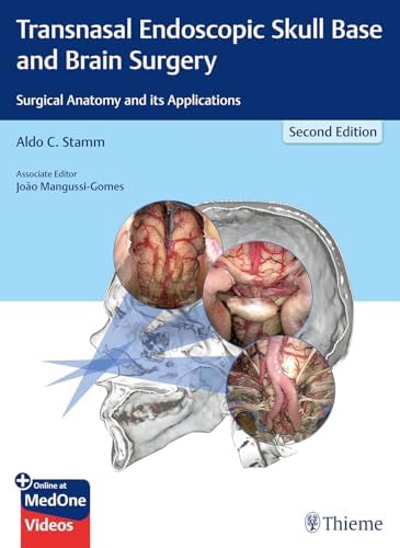 Handbook of Skull Base Surgery: 9781626230255: Medicine & Health