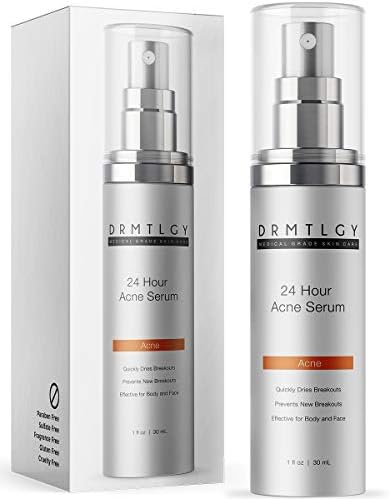 best cystic acne treatment