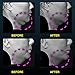 H-Art Chin Up Patch, V line, Double Chin Reducer, Face Lift, Contour Lifting Firming Moisturizing Mask, All Night, Silicone V-Line Lifting Patches - 5 Strips