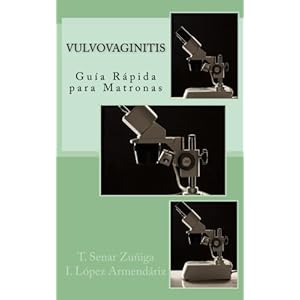 Guía Rápida de Vulvovaginitis para Matronas (Spanish Edition)