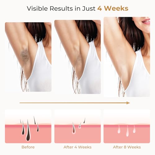Deplite 21J Epilatore Luce Pulsata con Funzione di Raffreddamento, Epilatore Laser indolore per Donna e Uomo, 9 Livelli di Energia, 999,900 Flashes Luce Pulsata IPL per, Corpo, Ascelle, Bikini