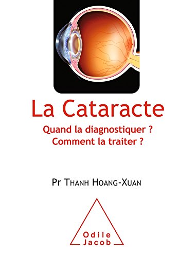 La cataracte : Quand la diagnostiquer ? Comment la traiter ? by 