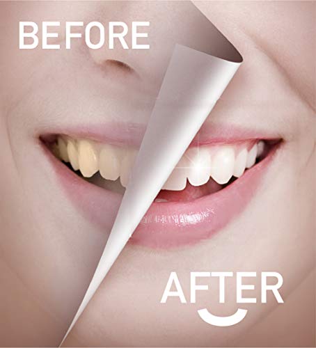 Teeth Whitening Gel Pen - GlorySmile Teeth Whitening Treatments Kit Safe 35% Carbamide Peroxide Effective No Sensitivity Teeth Whitener Travel-Friendly Dental Whitening Pen(3 Pack)