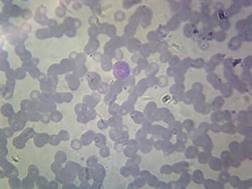 Ciliata; Balantidium Coli Trophozoites - Microscope Slide