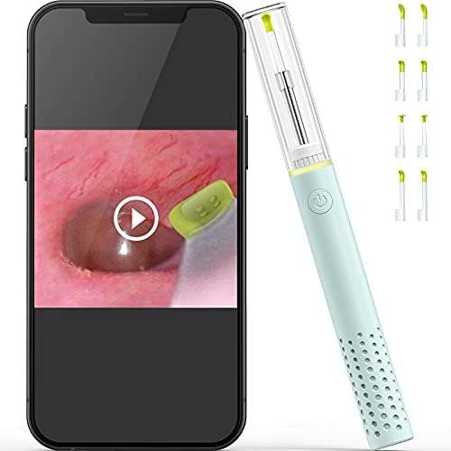 Otoscope Ear Wax Removal with Camera, ScopeAround HD Otoscope with 6