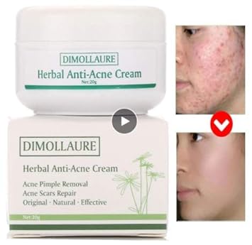 pimple beauty cream