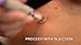 ICY Cold Diabetic Pre Shot/Injection Skin Numbing Pain Relief Device - by Mars Wellness