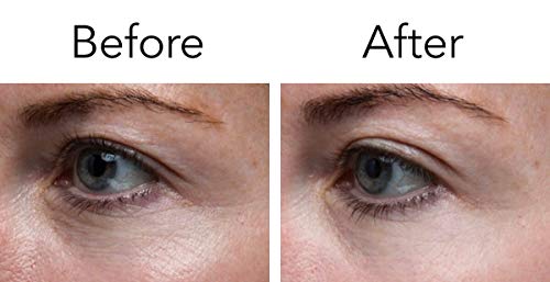 Pronexa Lavish Eyes: Anti-Aging Under Eye Gel Serum to Reduce the Appearance of Dark Circles, Puffiness, Bags, Wrinkles, Fine Lines & Crows Feet Around Eyes. 1.0 FL OZ.