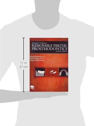 Stewart's Clinical Removable Partial Prosthodontics (Phoenix, Stewart's Clinical Removable Partial Prosthodontics)