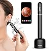 Aabld P1 Pro Ear Wax Removal Tool, Wireless Endoscope Otoscope Camera 1080P FHD with 6 LED Lights, Suitable for iOS…