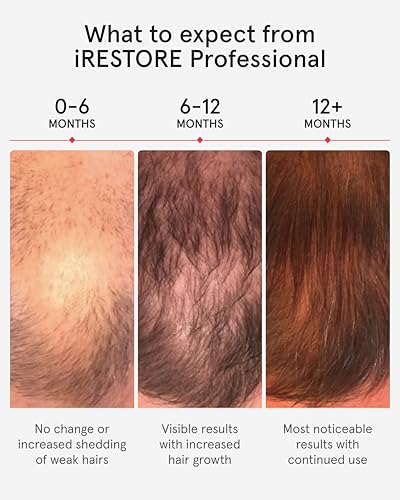 iRestore Professional Laser Hair Growth System-FDA Cleared Laser Cap Hair Growth for Men & Hair Regrowth Treatments for Women, Hair Loss Treatments Hair Cap, Like Laser Comb for Hair Growth Products