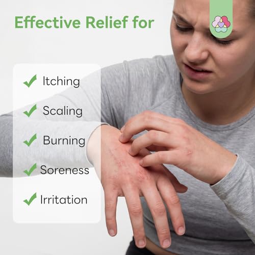 SAVILAND Antifungal Cream FSA-HSA Max Strength: 25% Undecylenic Acid Anti Fungal Cream for Skin Athletes Foot Jock Itch Ringworm Foot Fungus Treatment Comfort with Tea Tree & Oregano Oil 4.23 oz