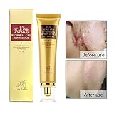GARYOB Acne Scar Removal Cream Skin Repair Face Cream for Burns Cuts Operation Stretch Mark Remover Acne Scar Treatment