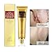 GARYOB Acne Scar Removal Cream Skin Repair Face Cream for Burns Cuts Operation Stretch Mark Remover Acne Scar Treatment