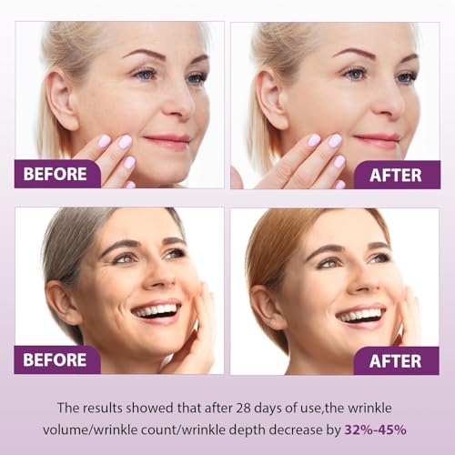 Lboylove® 2 Pcs Bakuchiol Retinol Serum, Rejuvenation Serum For Anti-Wrinkles And Glowskin, Face Men & Women