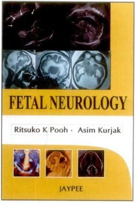 Fetal Neurology