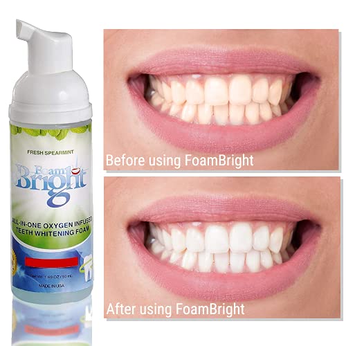 FoamBright Dual Aligner & Retainer Cleaner & Teeth Whitening Foam