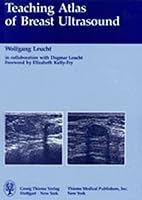 Teaching Atlas of Breast Ultrasound 3137741017 Book Cover