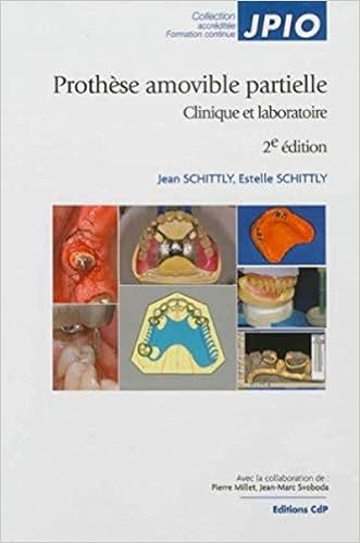 Prothese Amovible Partielle Clinique Et Laboratoire 2eme Edition Jpio French Edition Schittly Jean Schittly Estelle Millet Pierre Svoboda Jean Marc 9782843612176 Amazon Com Books