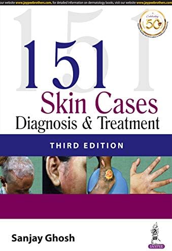 151 Skin Cases: Diagnosis & Treatment