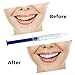 HailiCare Tooth Whitener, Teeth Whitening Gel Kit, White LED, 44% Dental Bleaching System