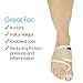 Vive Bunion Brace (Pair) - Big Toe Corrector Straightener with Splint - Hallux Valgus Pad, Joint Pain Relief, Alignment Treatment - Orthopedic Sleeve Foot Wrap Support for Men and Women (Beige)