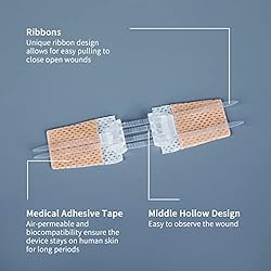 SEABIRD Emergency Wound Closure Device, Zip Sutures