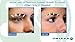 Omiera Anti Wrinkle Cream, Dark Spots Corrector, Acne Treatment, Hair Inhibitor, Dark Circles Under Eyes Treatment, Hair Growth Inhibitor, Eyelash Growth Serum Anti-Aging Skin Care Set