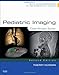 Pediatric Imaging:Case Review Series