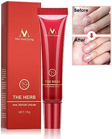 Fungus Treatment Nail Cream, Fungus Stop, Herb Nails Repair Cream,Anti Fungus Nail Treatment, Nail Fungus, Fungal Nail Solution, Toenails & Fingernails Ointment Treatment,15g