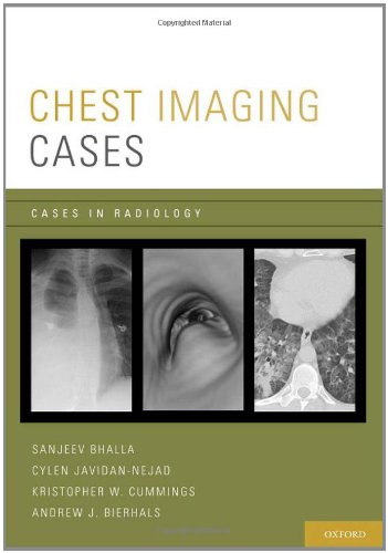 Chest Imaging Cases (Paperback)