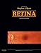 Retina (Ryan, Retina)