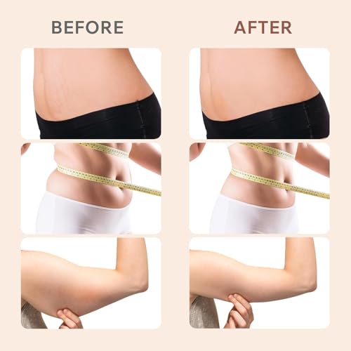 Professional Anti-Cellulite Massager, 3 in 1 Professional Anti-Cellulite Massager for Hands Tummy, Waist, Arms, Legs, Buttocks, Unisex, Lifting Effect