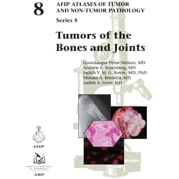 Tumors of the Prostate Gland, Seminal Vesicles, and Scrotum (AFIP