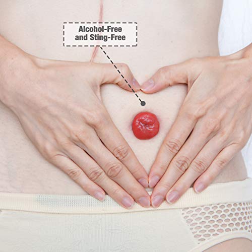 4 Safe+Simple+Peri+Stoma+Adhesive+Remover