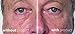 My Perfect Eyes Anti-Ageing Under Eye Enhancer 200 Applications with My Perfect Day SPF 15